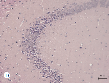 D小鼠海马CA区有较多锥体细胞体积缩小。并有明显核固缩